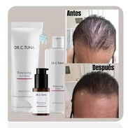 Shampoo y mascarilla para la caída del cabello - Img 54695320