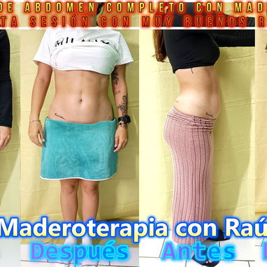 Masajista y Maderoterapeuta. En Spa Leydis brindamos múltiples servicios. Los esperamos. - Img 127881800
