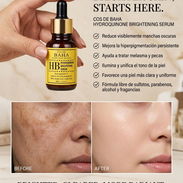 Hidroquinona para manchas, hiperpigmentación y melasma - Img 55819140