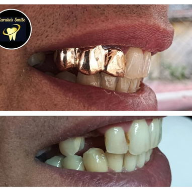 ✨💯Karuko Smiles 🤩✨Sonríe con estilo, Brilla con 🥇✨ Ponte pill@ 😁💪🏻 - 4/10