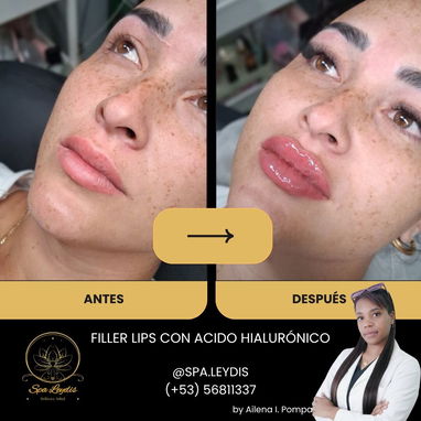 OFERTA DE VERANO EN SPA_LEYDIS MARIANAO - Img 124584836