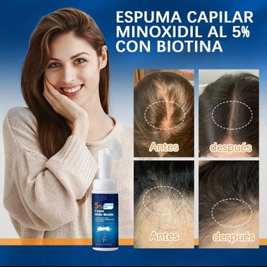 Espuma de Minoxidil ,botella de 60ml - Img 119814821