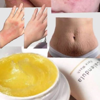 Bálsamo de Caléndula 🌼 de FARMASI. Ideal para hidratar la piel, tratar lesiones,piel sensible, psoriasis, manchas.. - 2/5