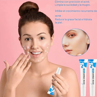 Crema para el acne - 2/2