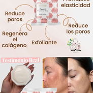 🔥¿Buscas aclarar manchas,melasma?👀👇🏻 - Img 54696181