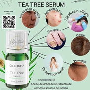 Elimina hongos de las uñas con el suero de tea tree - Img 55048688