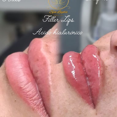 OFERTA DE VERANO EN SPA_LEYDIS MARIANAO - Img 124584878