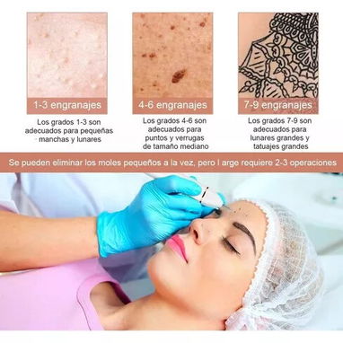 Cauterizador Quita Verrugas, Manchas, Pecas 58757374 - Img 76586209