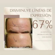 ‼️ BOTOX INSTANTÁNEO Farmasi‼️😍 - Img 54261447